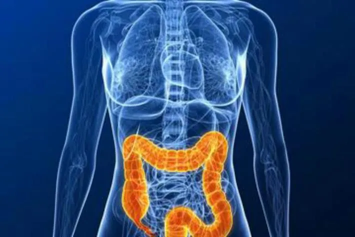 Colon-cancer-causes.webp