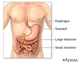 Crohn’s-disease_2.webp