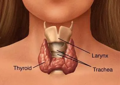 Graves'-disease.webp