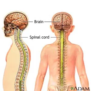 Meningitis_3.webp