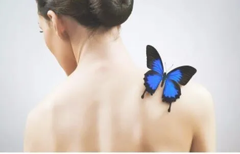 back-acne-women-Butterfly.webp