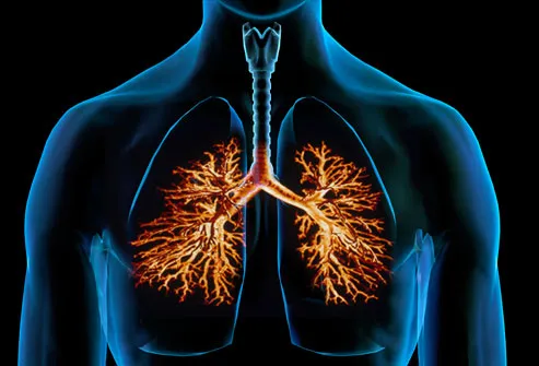 chronic-bronchitis-another.webp