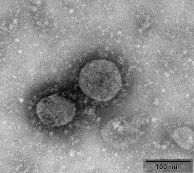 coronavirus.webp