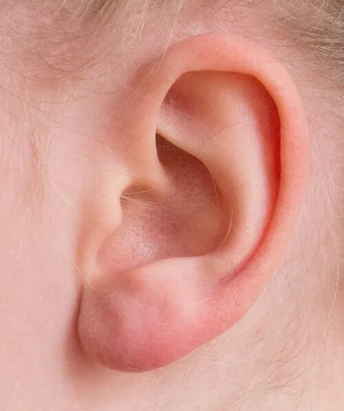 ear-women.webp