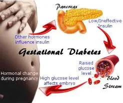 gestational-diabetes2.webp