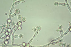 candida vaginitis