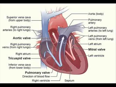 edema heart