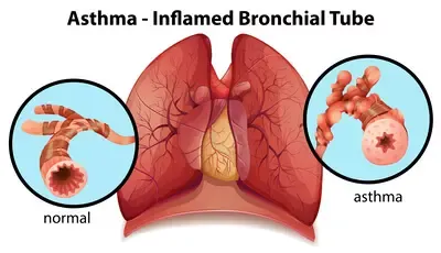 Lung_disease