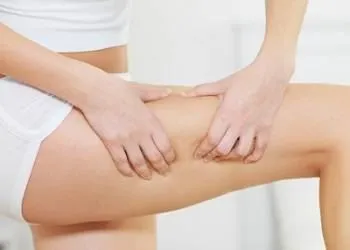 leg-diet-cellulite.webp