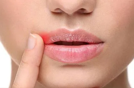 lip-care.webp