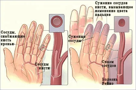 magnesium-effect_3.webp