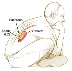 pancreatitis-_2.webp