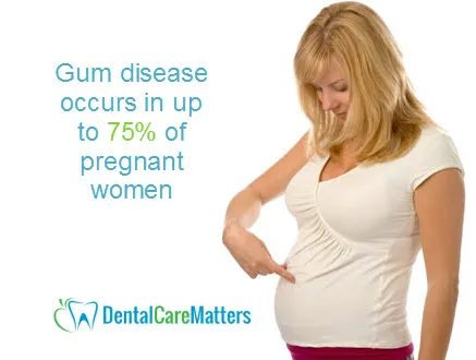 pregnancy-periodontal-disease.webp