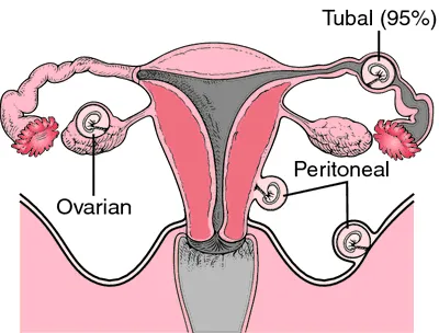 pregnancy_3.webp