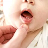 stomatitis-tooth.webp